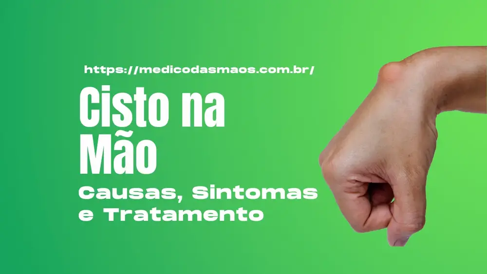 Cisto na Mão: Causas, Sintomas e Tratamento